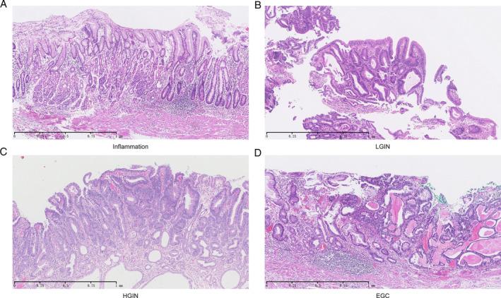 https://cdn.ncbi.nlm.nih.gov/pmc/blobs/a63f/7317417/5c0e06a61448/PATH-251-135-g001.jpg