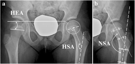 https://cdn.ncbi.nlm.nih.gov/pmc/blobs/a641/5686794/bd3dbdc474fd/12891_2017_1833_Fig1_HTML.jpg