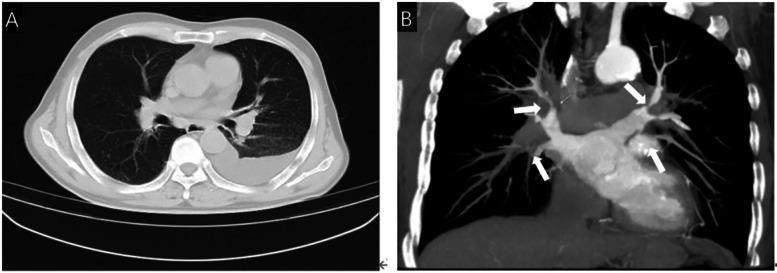 https://cdn.ncbi.nlm.nih.gov/pmc/blobs/a642/12391052/f7dd767456b5/fcvm-12-1633432-g001.jpg