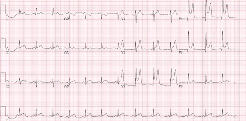 https://cdn.ncbi.nlm.nih.gov/pmc/blobs/a642/7925058/74acd273d327/cureus-0013-00000013054-i01.jpg