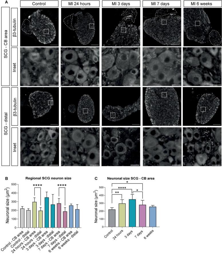 https://cdn.ncbi.nlm.nih.gov/pmc/blobs/a646/9582601/0093a308922c/fcvm-09-758265-g002.jpg