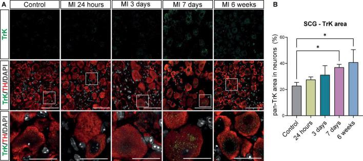 https://cdn.ncbi.nlm.nih.gov/pmc/blobs/a646/9582601/1f673aaf03f2/fcvm-09-758265-g006.jpg