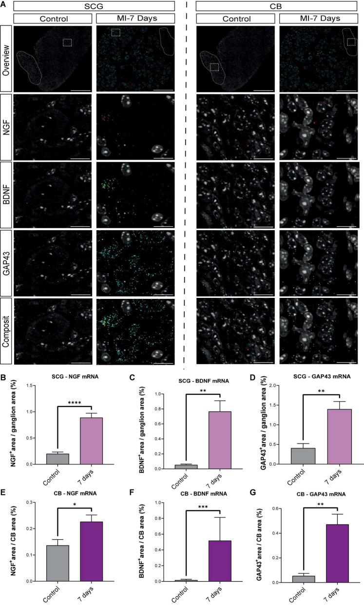 https://cdn.ncbi.nlm.nih.gov/pmc/blobs/a646/9582601/21dbf1d964a9/fcvm-09-758265-g008.jpg