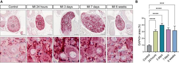 https://cdn.ncbi.nlm.nih.gov/pmc/blobs/a646/9582601/62e04597a9db/fcvm-09-758265-g007.jpg
