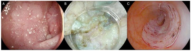 https://cdn.ncbi.nlm.nih.gov/pmc/blobs/a653/11987842/fc8bfc85681a/cancers-17-01242-g001.jpg