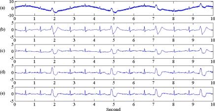 https://cdn.ncbi.nlm.nih.gov/pmc/blobs/a657/3247747/2f4651b1a76a/sensors-10-06063f9.jpg