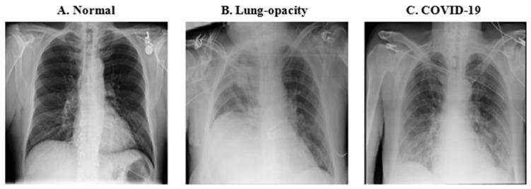 https://cdn.ncbi.nlm.nih.gov/pmc/blobs/a65f/11353409/7f85c1b0e85e/diagnostics-14-01727-g001.jpg