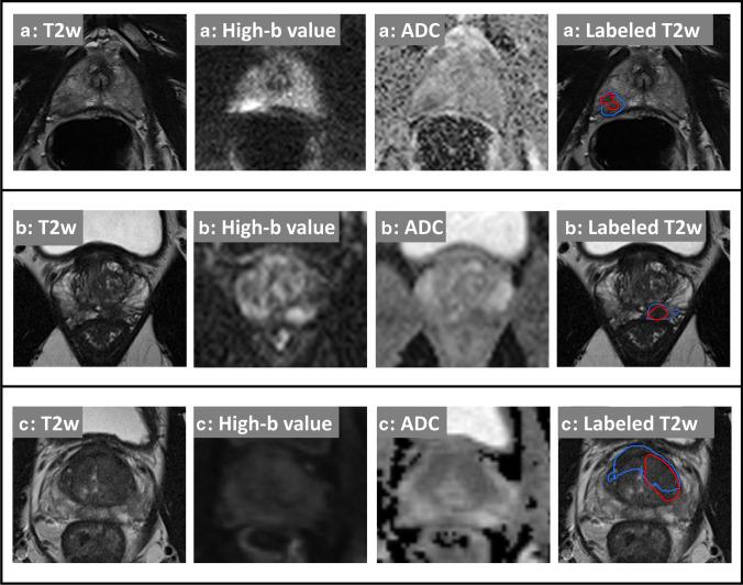 https://cdn.ncbi.nlm.nih.gov/pmc/blobs/a660/10598076/58e518efd7a2/330_2023_9882_Fig2_HTML.jpg