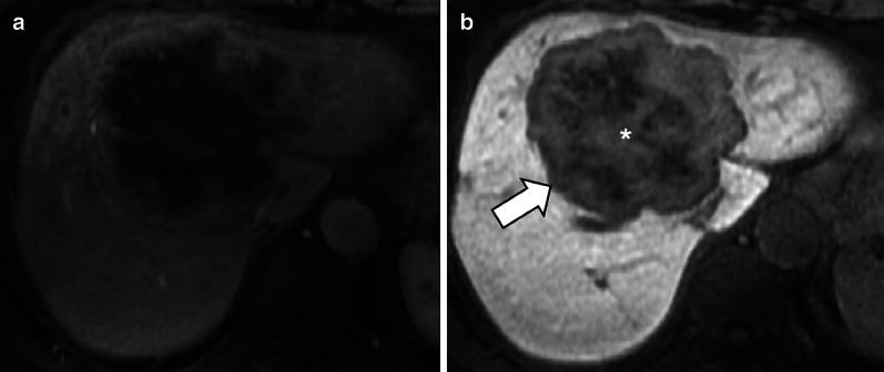 https://cdn.ncbi.nlm.nih.gov/pmc/blobs/a660/7801550/54dc4038677d/13244_2020_928_Fig11_HTML.jpg