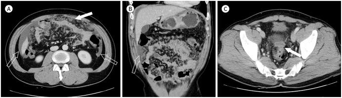 https://cdn.ncbi.nlm.nih.gov/pmc/blobs/a669/9431935/2e4d2102c2bc/jksr-82-335-g001.jpg