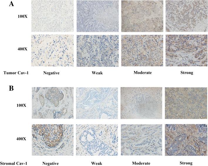 https://cdn.ncbi.nlm.nih.gov/pmc/blobs/a66d/6196471/91380684f920/12885_2018_4936_Fig4_HTML.jpg