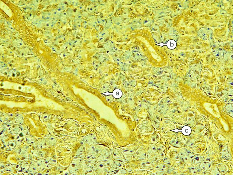 https://cdn.ncbi.nlm.nih.gov/pmc/blobs/a675/12040290/d3e69f2b6fed/cureus-0017-00000081465-i03.jpg