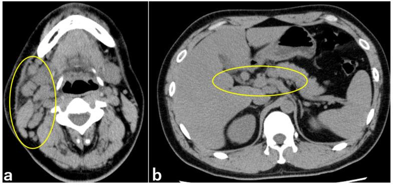 https://cdn.ncbi.nlm.nih.gov/pmc/blobs/a679/11433750/33d9cd72983a/medicina-60-01425-g002.jpg