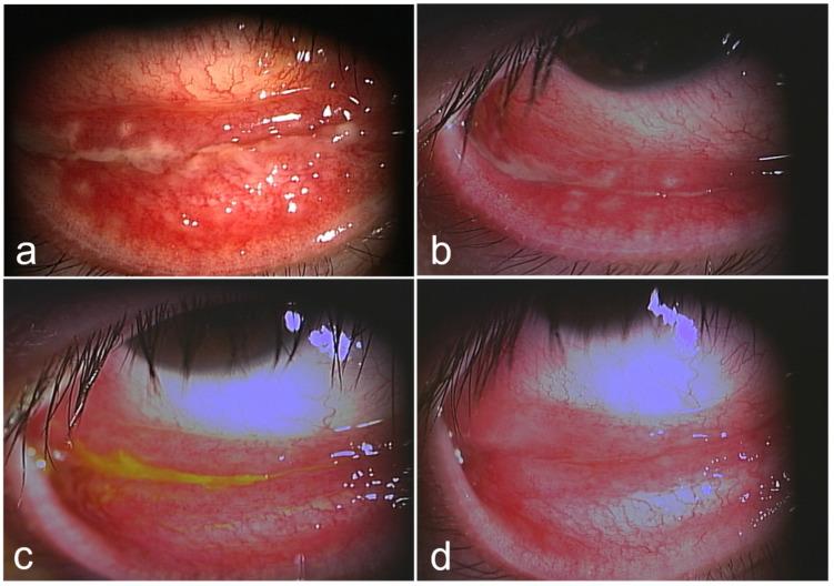 https://cdn.ncbi.nlm.nih.gov/pmc/blobs/a679/11433750/42f771533dba/medicina-60-01425-g003.jpg