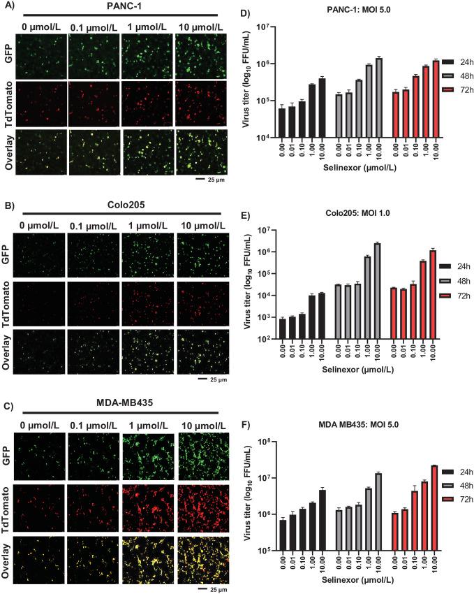 https://cdn.ncbi.nlm.nih.gov/pmc/blobs/a680/10234290/7247598081ea/crc-22-0483_fig2.jpg