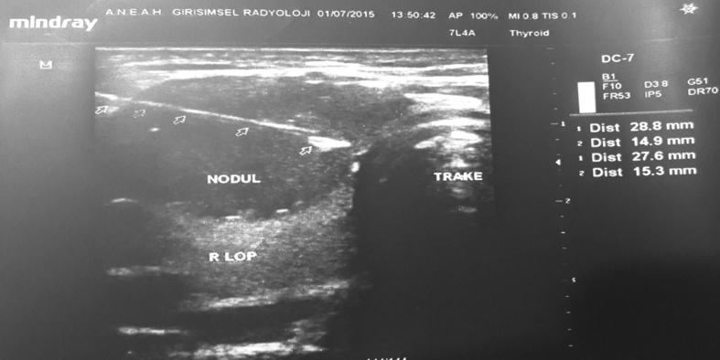 https://cdn.ncbi.nlm.nih.gov/pmc/blobs/a68a/4995479/bc0407591977/gr6.jpg