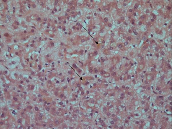 https://cdn.ncbi.nlm.nih.gov/pmc/blobs/a693/3977671/1a9bbdbe03fb/1471-230X-14-60-2.jpg