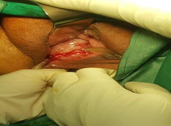 https://cdn.ncbi.nlm.nih.gov/pmc/blobs/a694/7072025/a0310e92865f/JFRH-13-173-g001.jpg