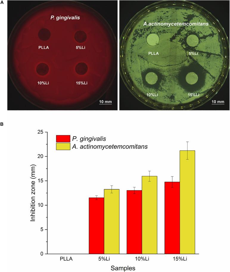 https://cdn.ncbi.nlm.nih.gov/pmc/blobs/a695/8116607/69e38b1d50be/fbioe-09-676874-g013.jpg