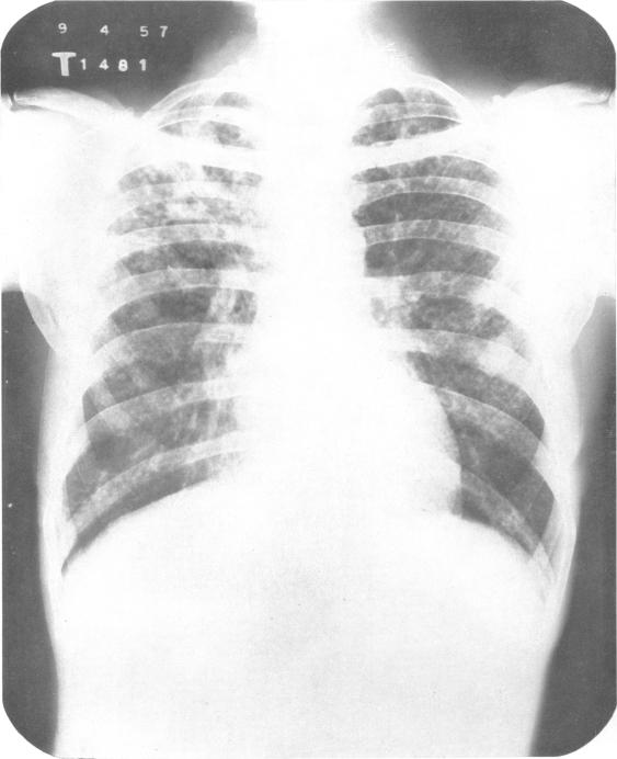 https://cdn.ncbi.nlm.nih.gov/pmc/blobs/a696/2537809/248e251a7d79/bullwho00501-0146-a.jpg