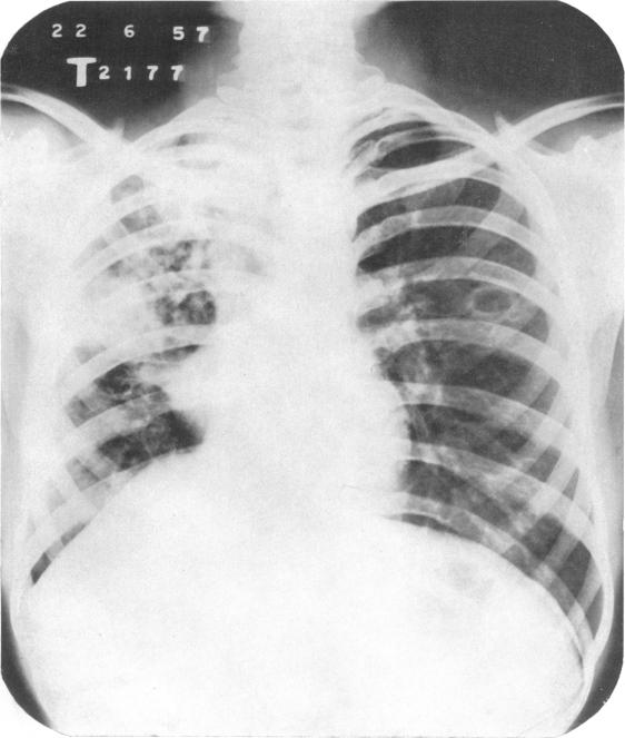 https://cdn.ncbi.nlm.nih.gov/pmc/blobs/a696/2537809/51641f058370/bullwho00501-0149-a.jpg
