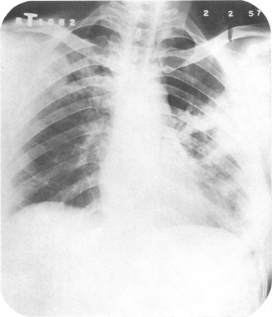 https://cdn.ncbi.nlm.nih.gov/pmc/blobs/a696/2537809/6bd12e36cf5f/bullwho00501-0144-a.jpg