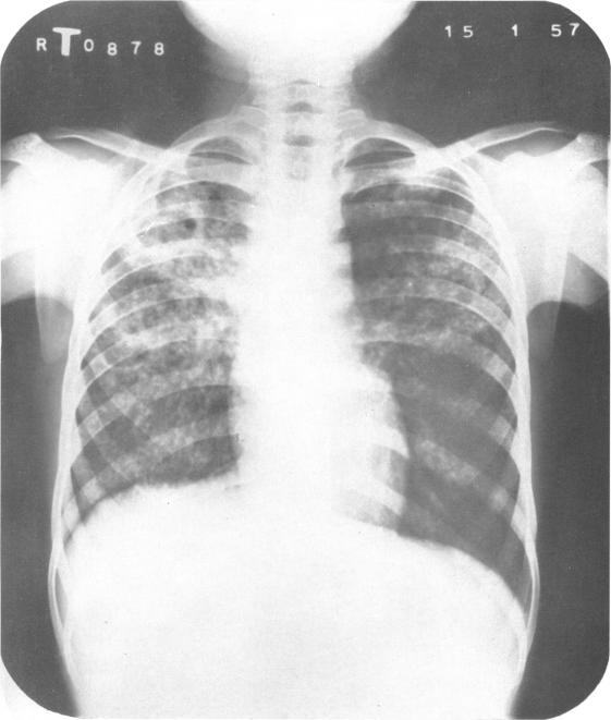 https://cdn.ncbi.nlm.nih.gov/pmc/blobs/a696/2537809/b722a50547cc/bullwho00501-0143-a.jpg