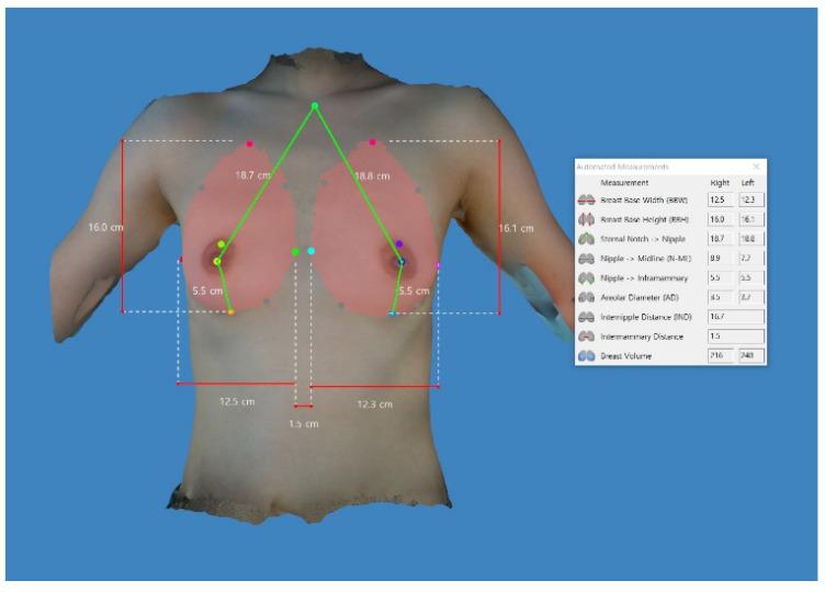 https://cdn.ncbi.nlm.nih.gov/pmc/blobs/a698/10048096/3d298a76262c/gels-09-00232-g006.jpg