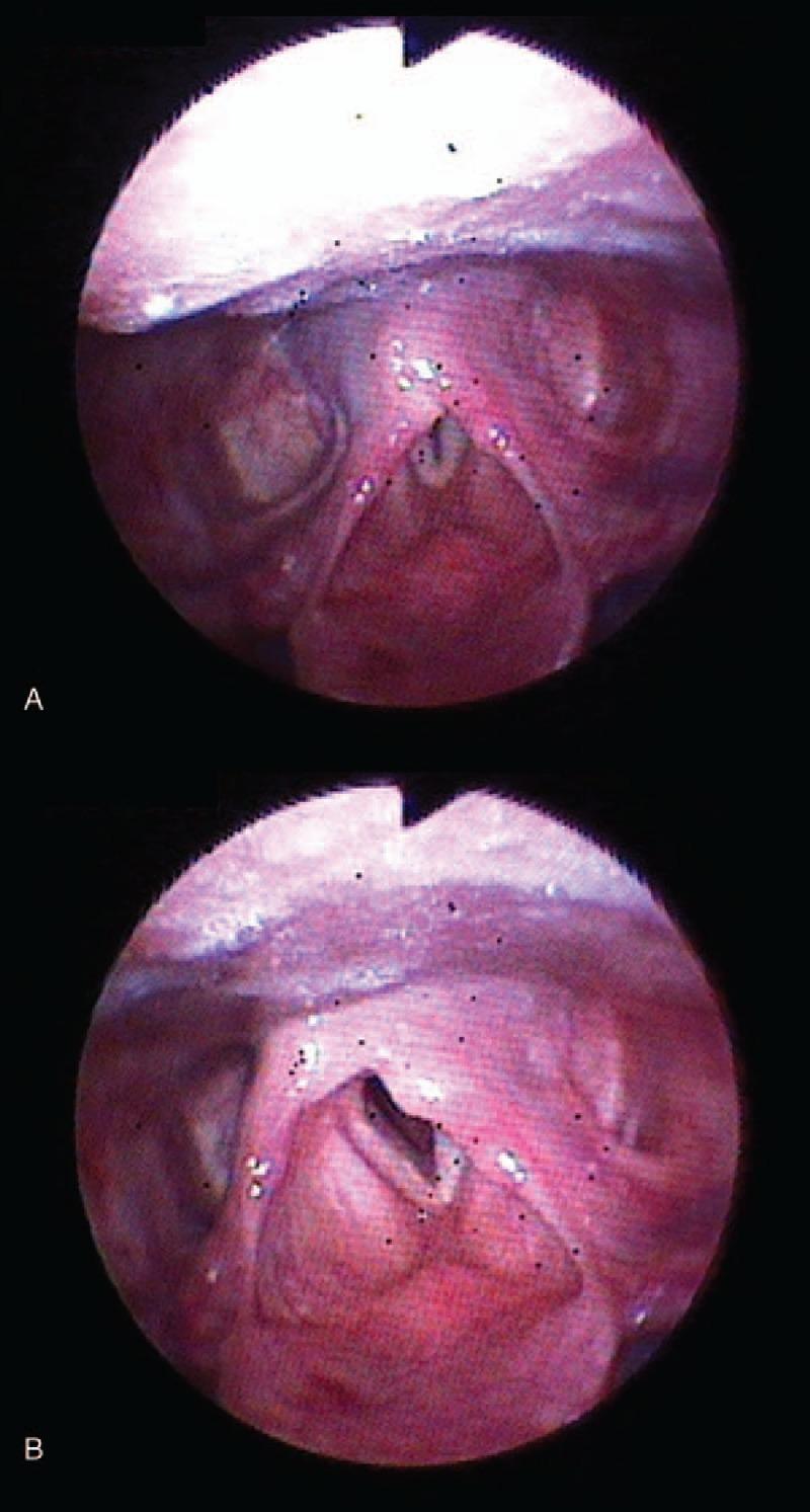 https://cdn.ncbi.nlm.nih.gov/pmc/blobs/a698/5403097/f63d42835b39/medi-96-e6598-g003.jpg