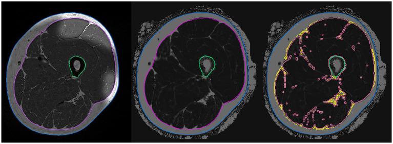 https://cdn.ncbi.nlm.nih.gov/pmc/blobs/a6a8/8335588/a069c8002580/fphys-12-700423-g001.jpg