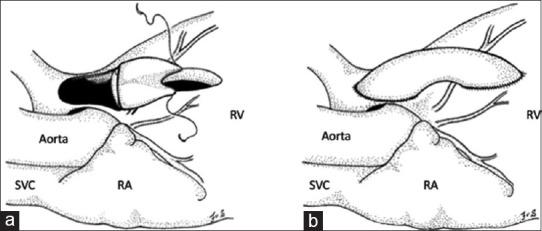 https://cdn.ncbi.nlm.nih.gov/pmc/blobs/a6b0/7918034/d346229ded1f/APC-14-53-g006.jpg