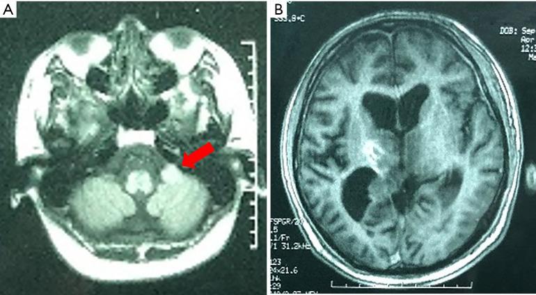https://cdn.ncbi.nlm.nih.gov/pmc/blobs/a6b1/8576728/7312623e9937/atm-09-20-1604-f7.jpg