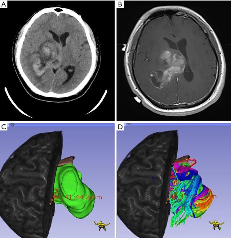 https://cdn.ncbi.nlm.nih.gov/pmc/blobs/a6b1/8576728/85d1f44b0672/atm-09-20-1604-f1.jpg