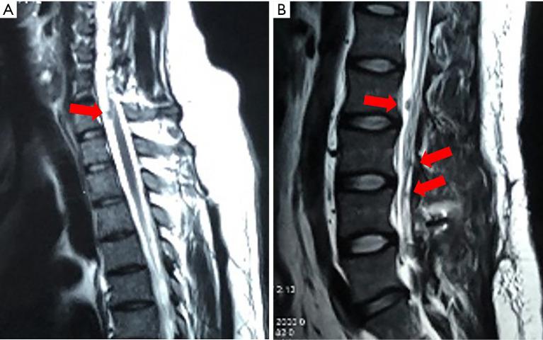 https://cdn.ncbi.nlm.nih.gov/pmc/blobs/a6b1/8576728/e81ad07592de/atm-09-20-1604-f6.jpg