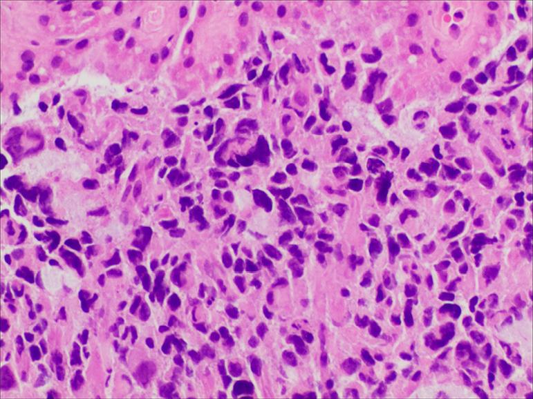 https://cdn.ncbi.nlm.nih.gov/pmc/blobs/a6b1/8576728/f5badc322669/atm-09-20-1604-f2.jpg