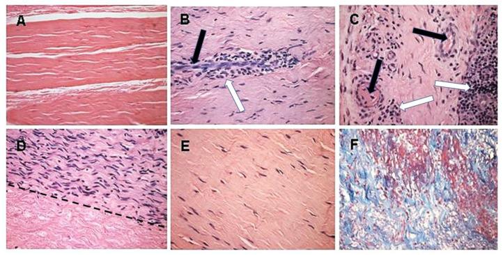 https://cdn.ncbi.nlm.nih.gov/pmc/blobs/a6b6/7826727/04e4febfc772/bioengineering-08-00010-g005.jpg