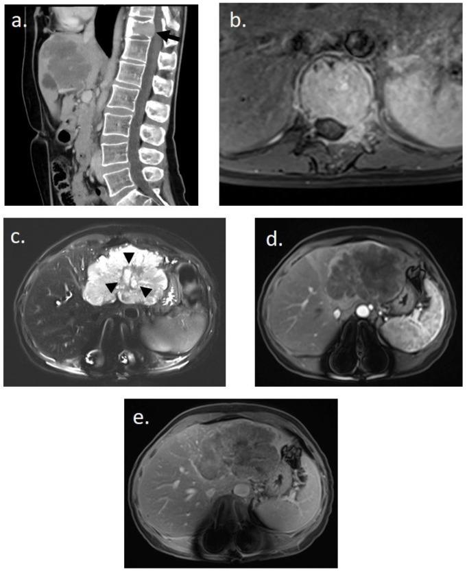 https://cdn.ncbi.nlm.nih.gov/pmc/blobs/a6b8/11431636/03bd7bb878d7/curroncol-31-00382-g001.jpg