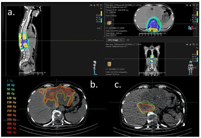 https://cdn.ncbi.nlm.nih.gov/pmc/blobs/a6b8/11431636/257aacf25916/curroncol-31-00382-g002.jpg