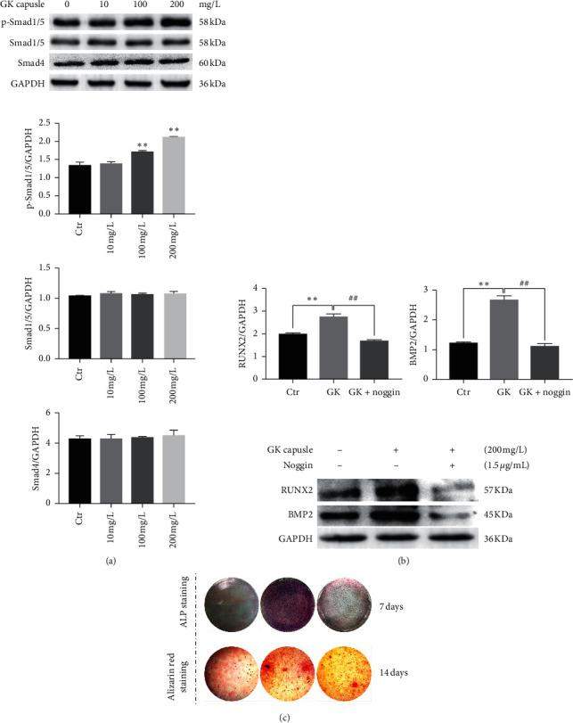 https://cdn.ncbi.nlm.nih.gov/pmc/blobs/a6be/7545469/e11f903bcff1/ECAM2020-7184502.005.jpg
