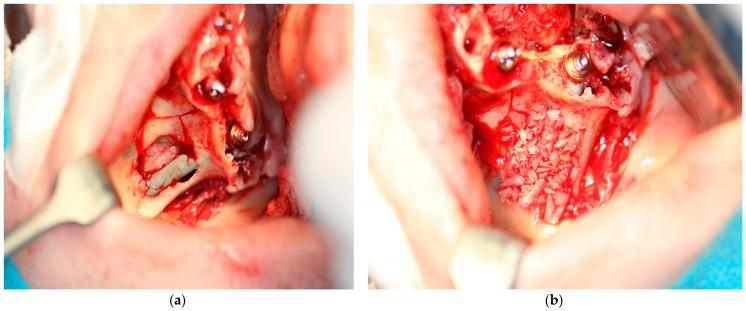 https://cdn.ncbi.nlm.nih.gov/pmc/blobs/a6c1/11818549/21c0841fec9f/jcm-14-00661-g007.jpg