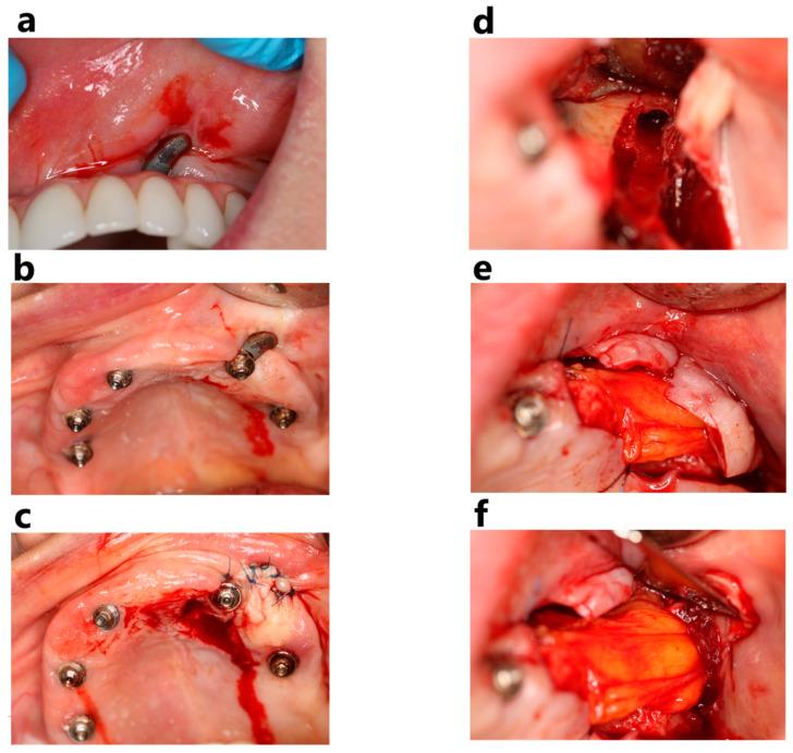 https://cdn.ncbi.nlm.nih.gov/pmc/blobs/a6c1/11818549/a394d8e9cc56/jcm-14-00661-g008.jpg