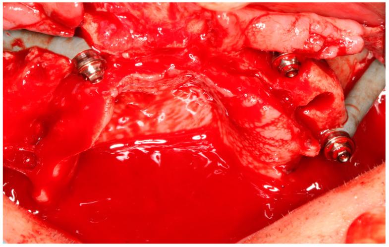 https://cdn.ncbi.nlm.nih.gov/pmc/blobs/a6c1/11818549/b896334902c1/jcm-14-00661-g006.jpg