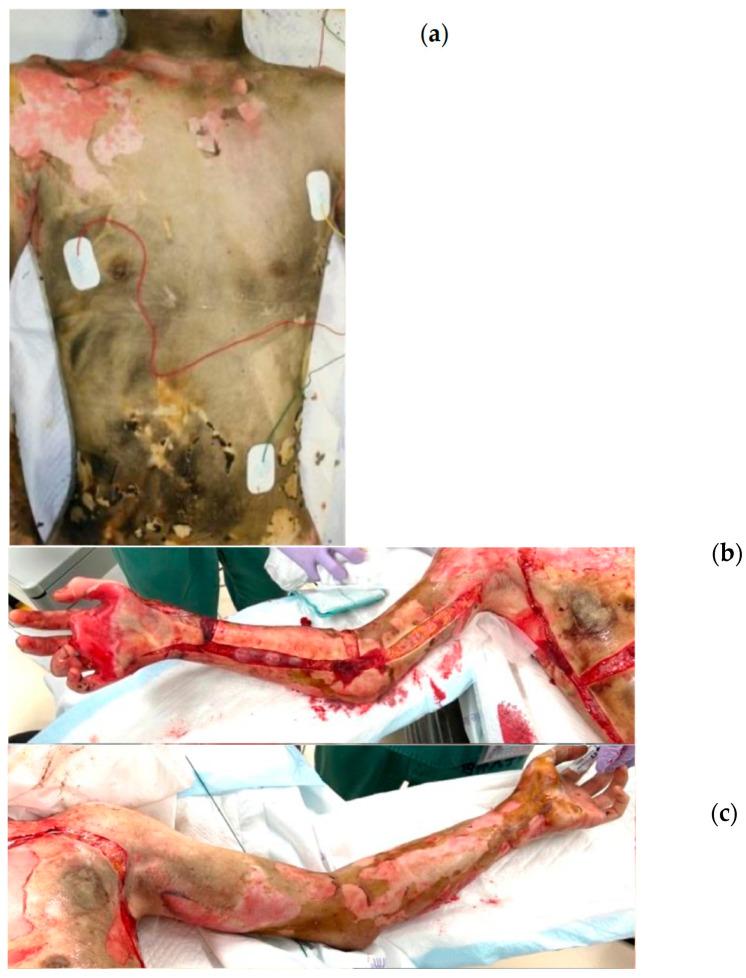 https://cdn.ncbi.nlm.nih.gov/pmc/blobs/a6cb/12347264/f2c50e1cf578/jcm-14-05233-g002a.jpg