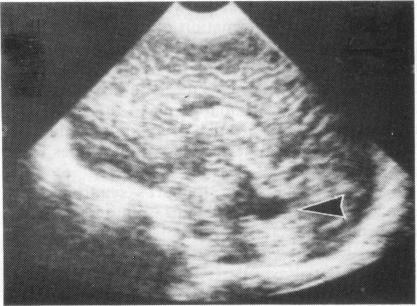 https://cdn.ncbi.nlm.nih.gov/pmc/blobs/a6cb/1628644/113da9bf4bf0/archdisch00731-0020-a.jpg