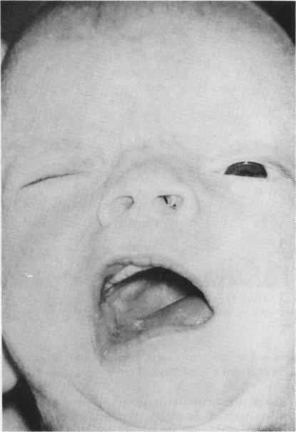 https://cdn.ncbi.nlm.nih.gov/pmc/blobs/a6cb/1628644/2fa2833974fb/archdisch00731-0021-a.jpg