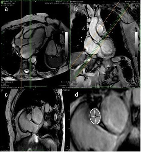 https://cdn.ncbi.nlm.nih.gov/pmc/blobs/a6cb/5351048/829970d685cc/12968_2017_344_Fig1_HTML.jpg