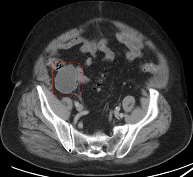 https://cdn.ncbi.nlm.nih.gov/pmc/blobs/a6cc/12060468/230a8f6e1c44/gr2.jpg