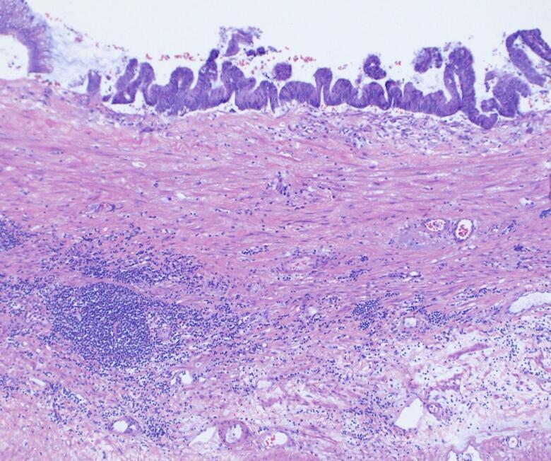 https://cdn.ncbi.nlm.nih.gov/pmc/blobs/a6cc/12060468/6e40a0d4dad3/gr7.jpg