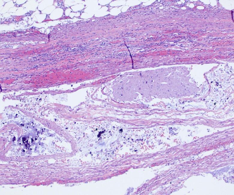 https://cdn.ncbi.nlm.nih.gov/pmc/blobs/a6cc/12060468/7da152b61185/gr8.jpg