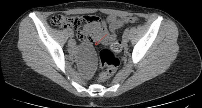 https://cdn.ncbi.nlm.nih.gov/pmc/blobs/a6cc/12060468/db8a6fa7081b/gr4.jpg